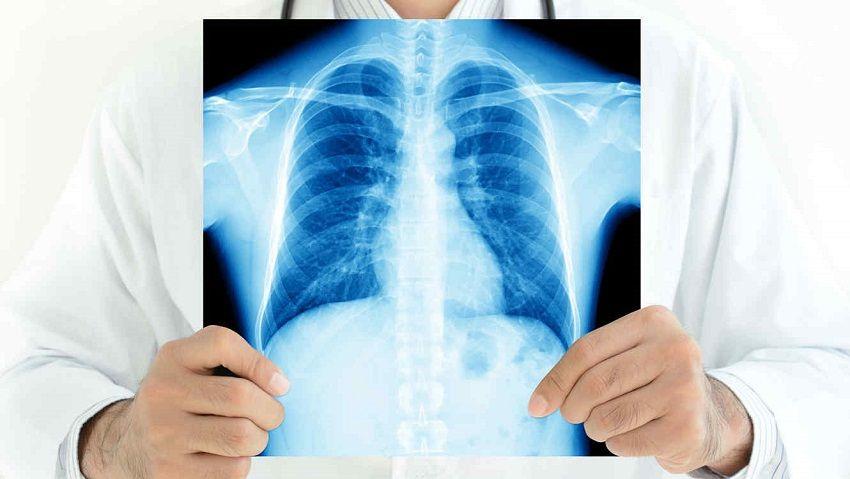 San Isidro se suma a la lucha contra el cáncer de pulmón