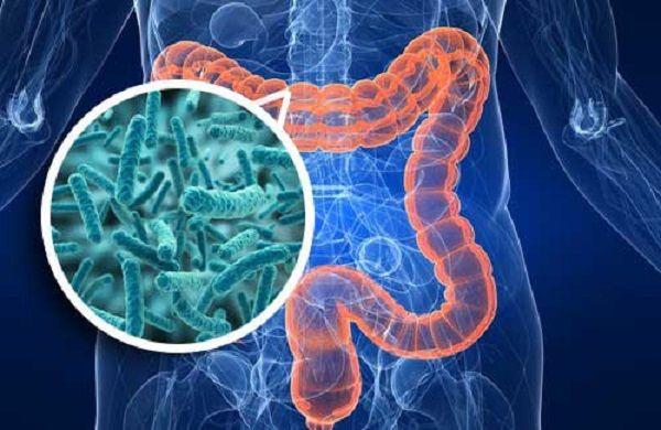 Recomiendan comenzar el control de prevención de cáncer de colon a los 45 años