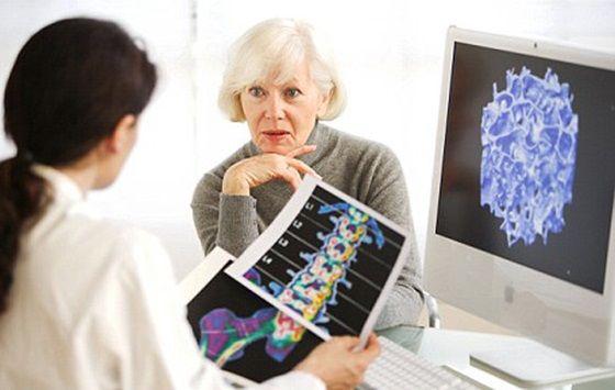 Osteoporosis: Qué es, síntomas. diagnóstico y tratamiento