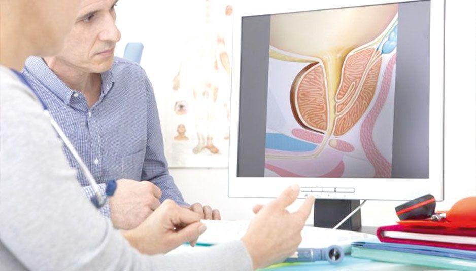 Cáncer de Próstata: en Argentina se detectan 3.700 casos anuales