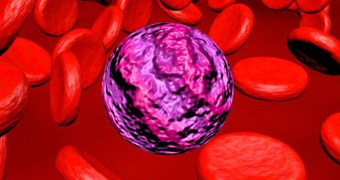 Llegó a la Argentina la primera terapia dirigida para la leucemia mieloide aguda