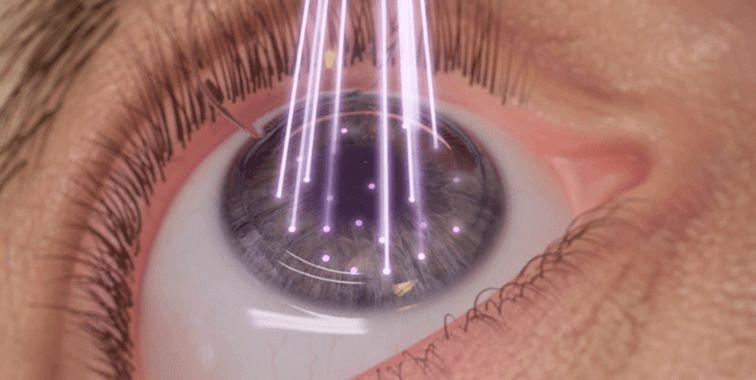 Entidades de oftalmología aseguran que la cirugía de ojos con láser