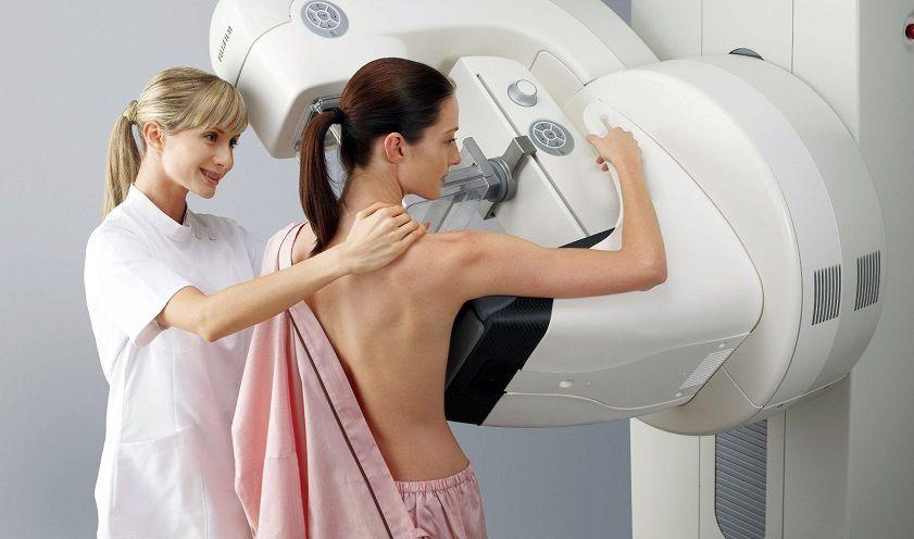 Buscan evitar la quimioterapia en tumores tempranos de cáncer de mama