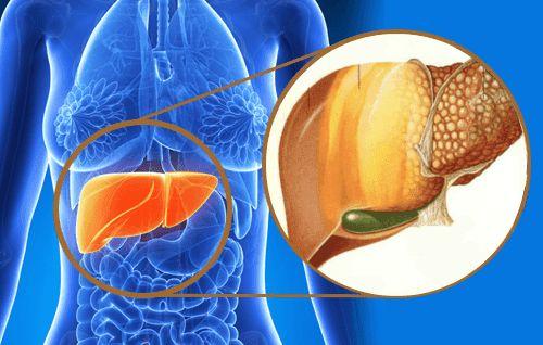 Hígado graso: Qué es, causas, síntomas y tratamiento