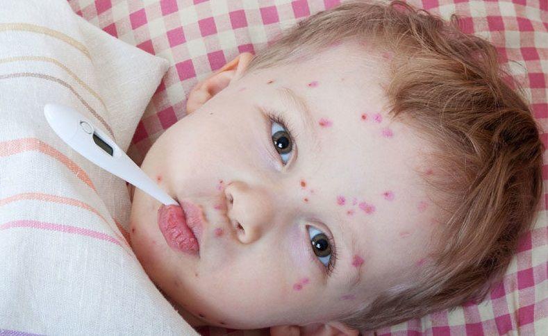 Alerta por dos casos autóctonos de sarampión