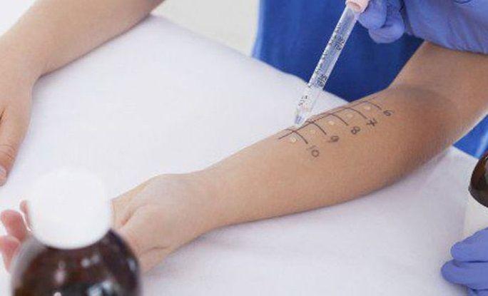 Alergia a la penicilina: Síntomas, causas, diagnóstico y tratamiento