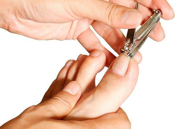 Uña encarnada: Qué es, causas, prevención y tratamiento