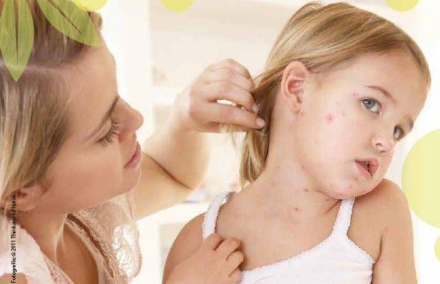 Alarma por brote récord de sarampión en Europa