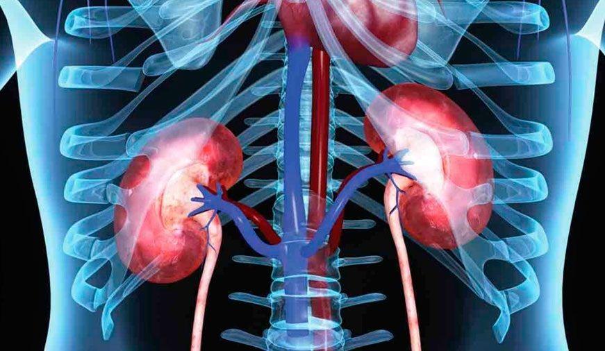 La contaminación del aire puede ser una amenaza para los riñones