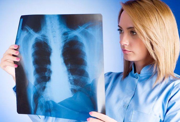 Alarmante avance del cáncer: calculan que casi 10 millones de personas morirían este año