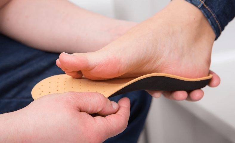 Pie plano: Qué es, síntomas, qué causa, diagnóstico y tratamiento