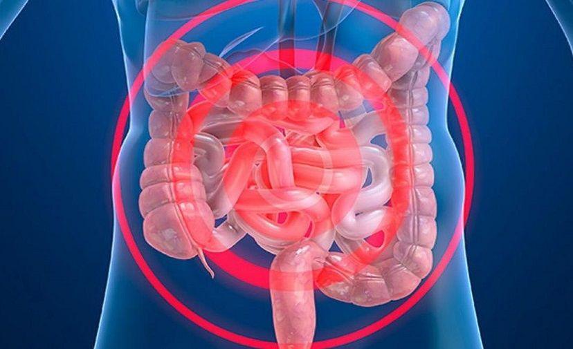 Takeda realiza el primer estudio sobre Enfermedad Inflamatoria Intestinal en el país