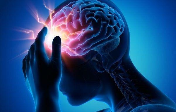 Migraña: Qué es, causas, síntomas, diagnóstico y tratamiento