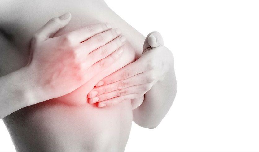 Mitos y verdades sobre el cáncer de mama