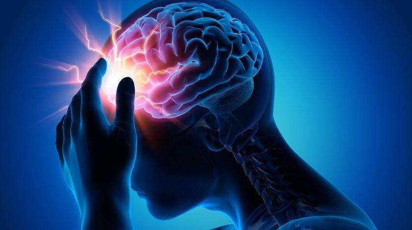 Un ataque de ACV mata 2 millones de neuronas por minuto