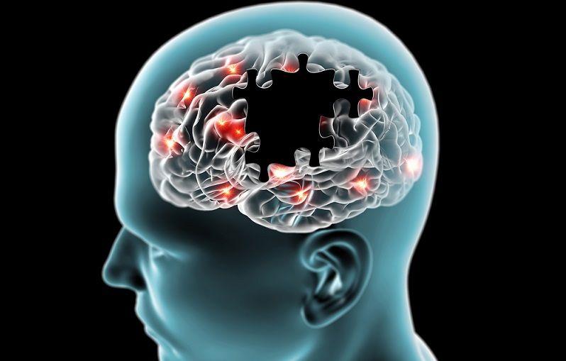 Logran adelantar 6 años el diagnóstico de la enfermedad de Alzheimer