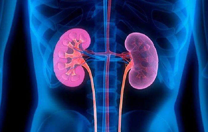 Enfermedad renal crónica; qué es, causas, síntomas y tratamiento