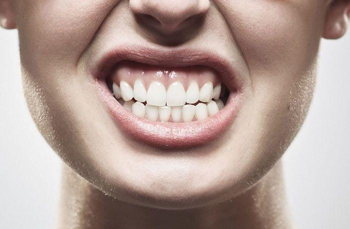 Bruxismo: qué es, causas, síntomas, diagnóstico, tratamiento y prevención