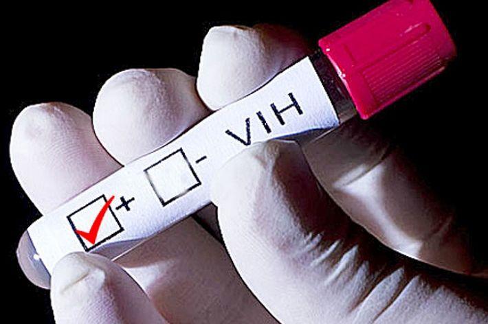 VIH: hoy son los adolescentes el grupo más vulnerable al contagio