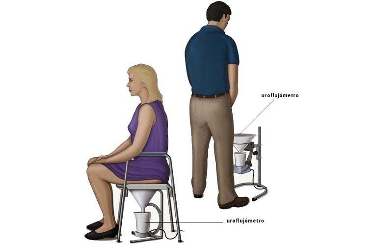 Qué es una uroflujometría