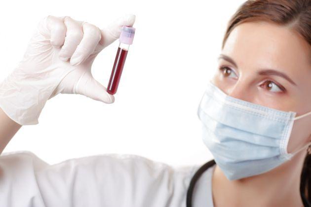 IOMA: los afiliados con patologías crónicas realizarán sus análisis de laboratorio gratuitamente