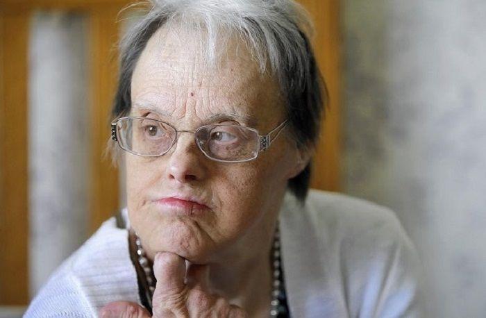 Síndrome de Down y envejecimiento: Fleni estudia aspectos neurológicos, cognitivos y neuropsiquiátricos