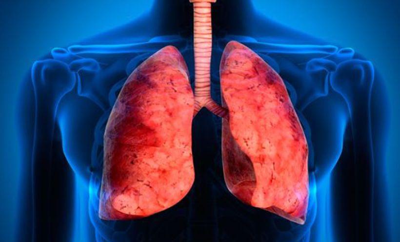 San Isidro: Recomiendan cómo prevenir y tratar la tuberculosis