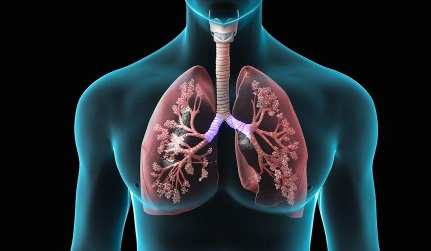ANMAT aprobó nuevo tratamiento para la hipertensión arterial pulmonar