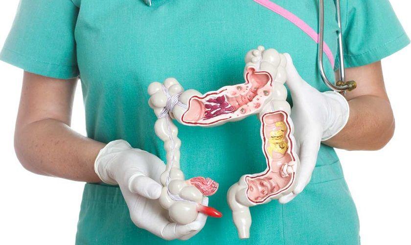 San Isidro concientiza sobre la detección temprana del cáncer de colon