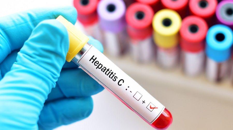 Al menos el 60% de los infectados con hepatitis C ignoran que portan el virus