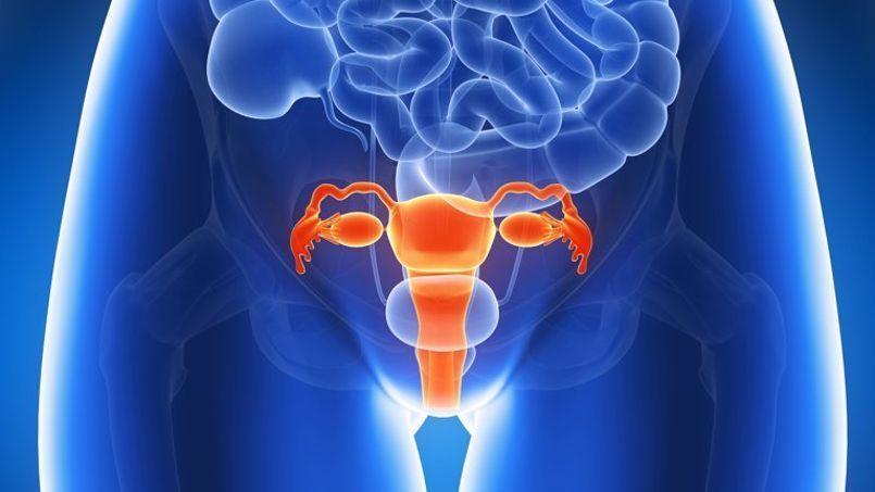 Nuevo tratamiento para cáncer de cuello uterino disponible en Argentina