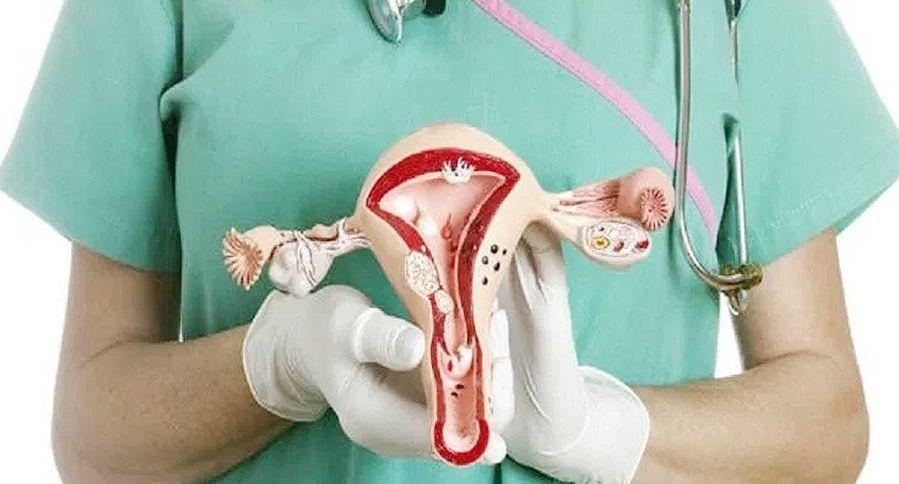 Cáncer de ovario: el 70% de los casos se diagnostican en etapas avanzadas