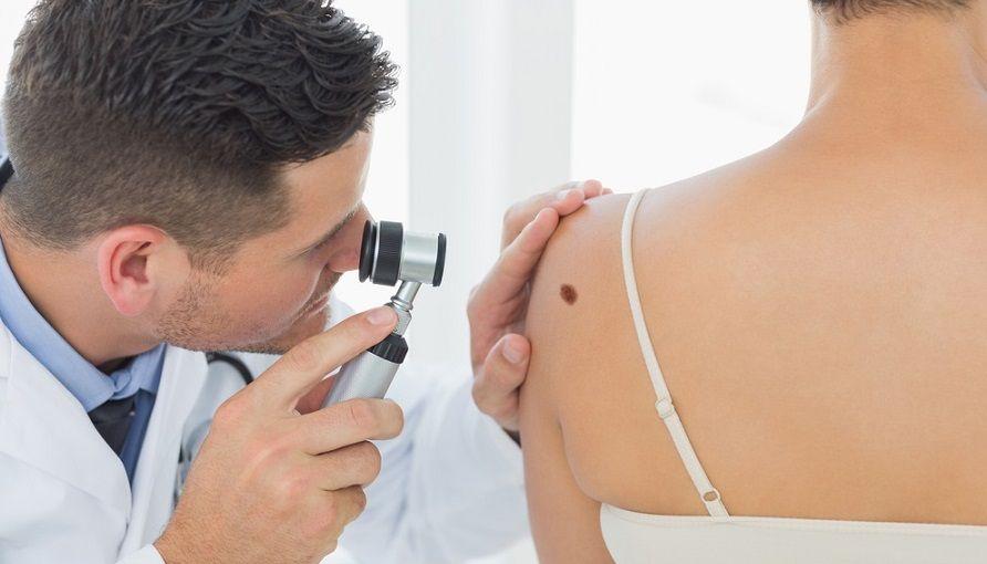 Campaña para informar sobre el melanoma, el cáncer de piel más agresivo