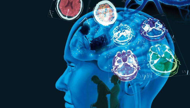 Todos las formas de Esclerosis Múltiple tienen tratamiento