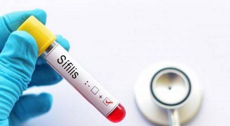 Se triplicaron los casos de sífilis en el país