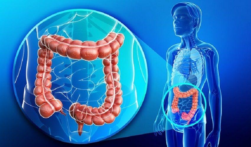 Estudio: 8 de cada 10 casos de cáncer de colon metastásico se diseminan antes de su diagnóstico
