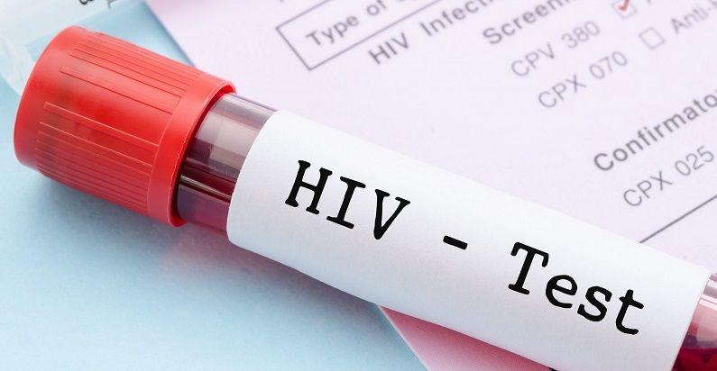 El diagnóstico a tiempo mejora la calidad de vida de las personas con VIH