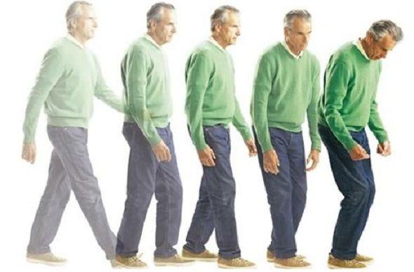 El origen del Parkinson estaría en el intestino