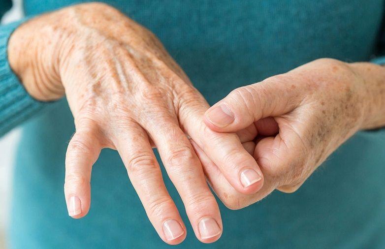 Artritis reumatoide: Causas, síntomas, diagnóstico y tratamientos