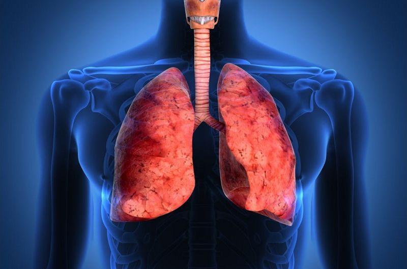 La tuberculosis no está erradicada en Argentina