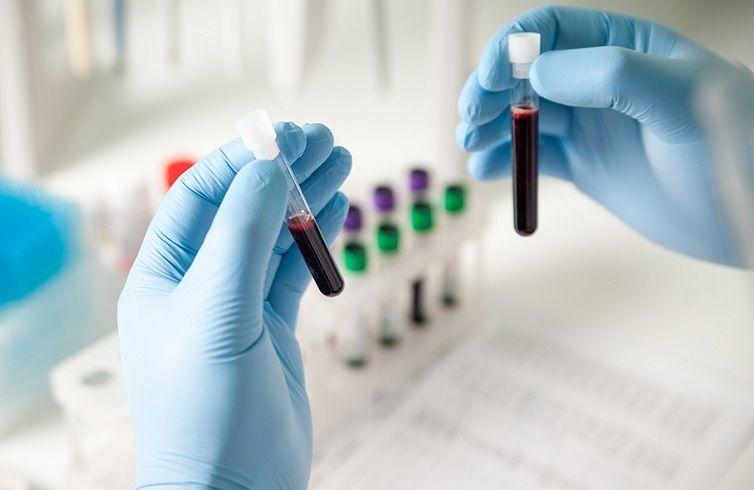 Análisis de sangre: ¿qué se evalúa y qué valores se encuentran dentro de la normalidad?