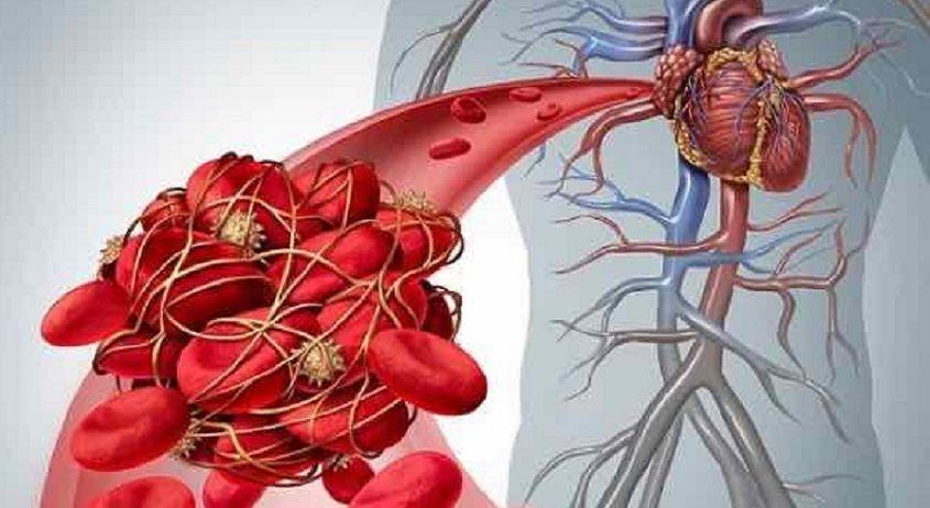 Argentina se suma al Día Mundial de la Trombosis