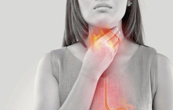 Reflujo gastroesofágico: qué es, síntomas, diagnóstico y tratamientos
