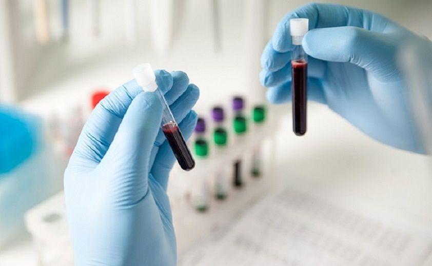 Diabetes: El Hospital Italiano invita a la comunidad a realizarse controles gratuitos