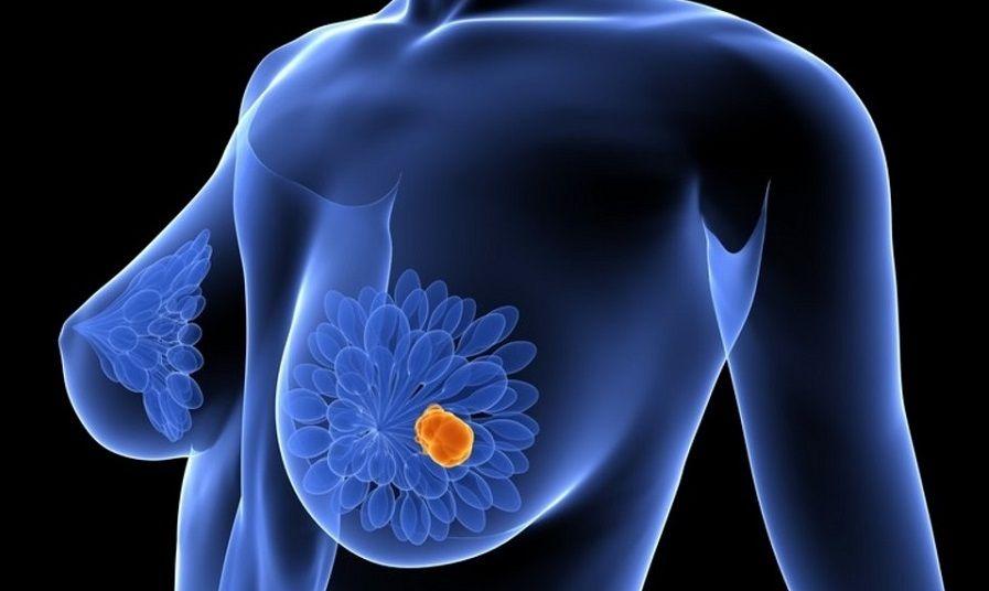 El Hospital Italiano aplica IA para la evaluación de la densidad mamaria mamográfica