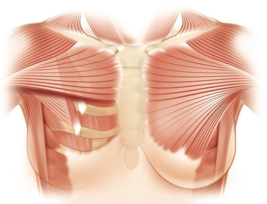 Síndrome de Poland y Pectus Excavatum, entre la cirugía y la aceptación emocional