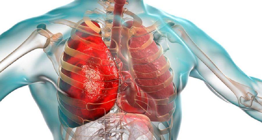 Argentina emitió un alerta epidemiológico por el coronavirus