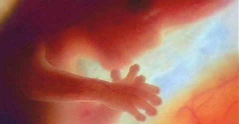 Un investigador pro aborto admite: los bebés por nacer pueden sentir dolor mucho antes de lo que se piensa