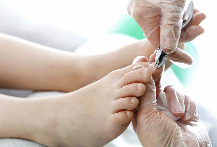 Uña encarnada del pie: causas, síntomas, tratamiento y prevención