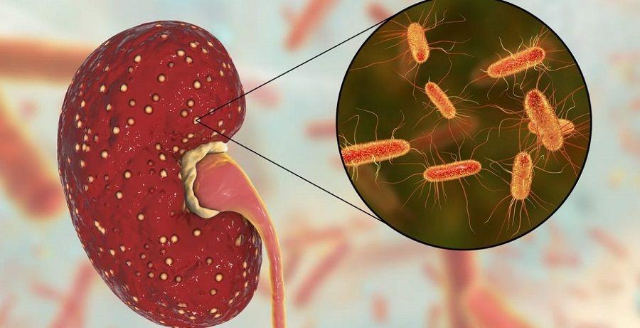 Argentina podría ser el primer país con un medicamento contra el SUH